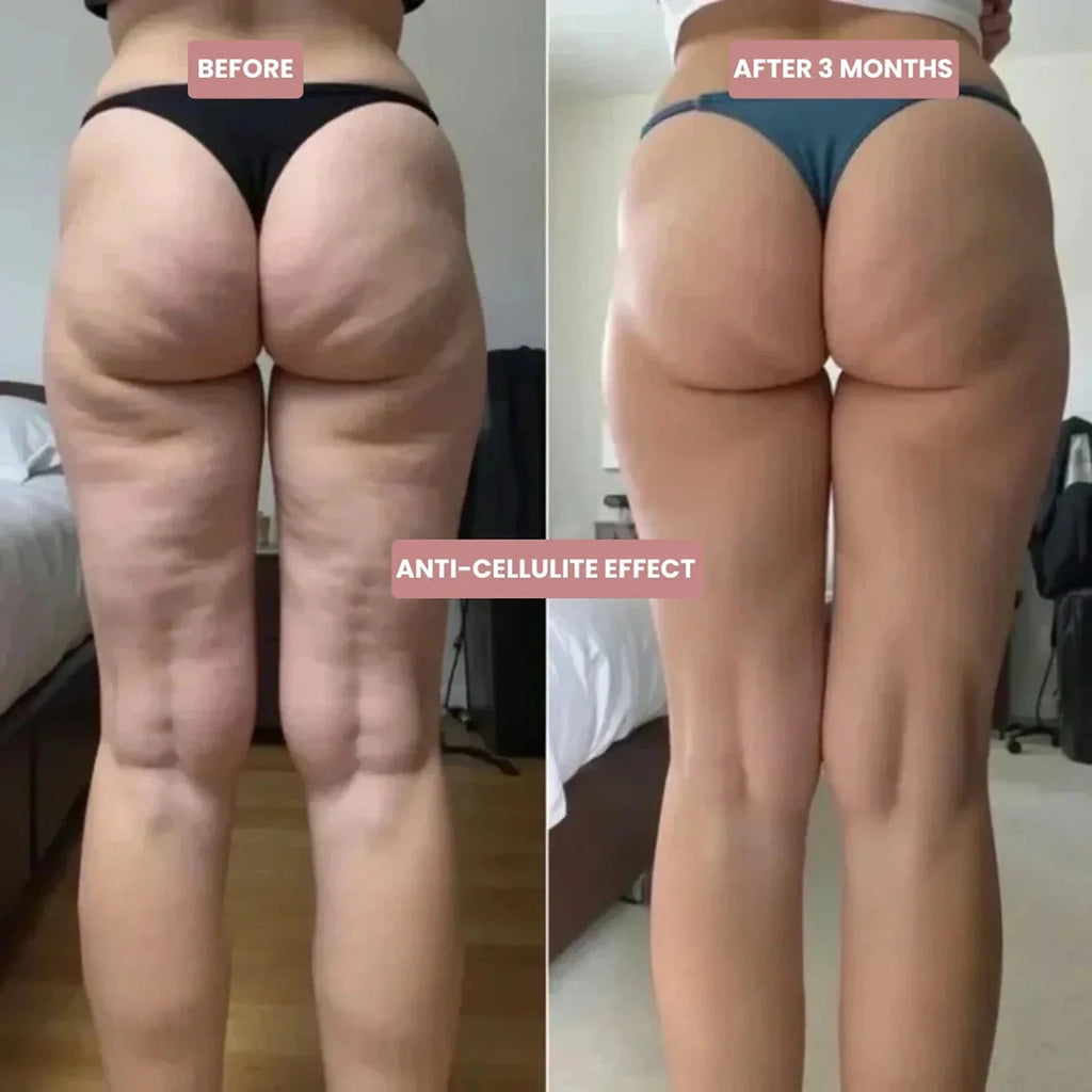 Cellumove 3D Legging – Definieren Sie Ihre Silhouette mühelos neu x